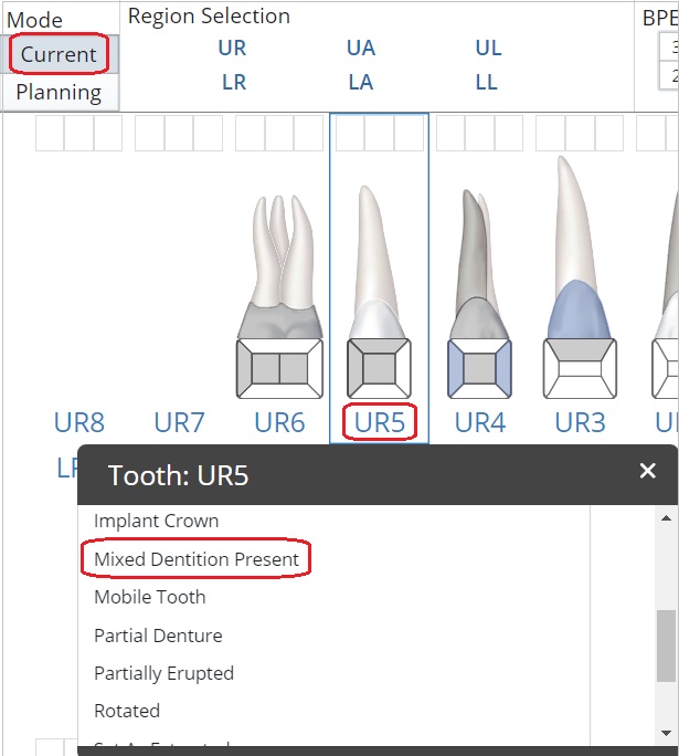 How to Chart Mixed Dentition – Carestream Dental
