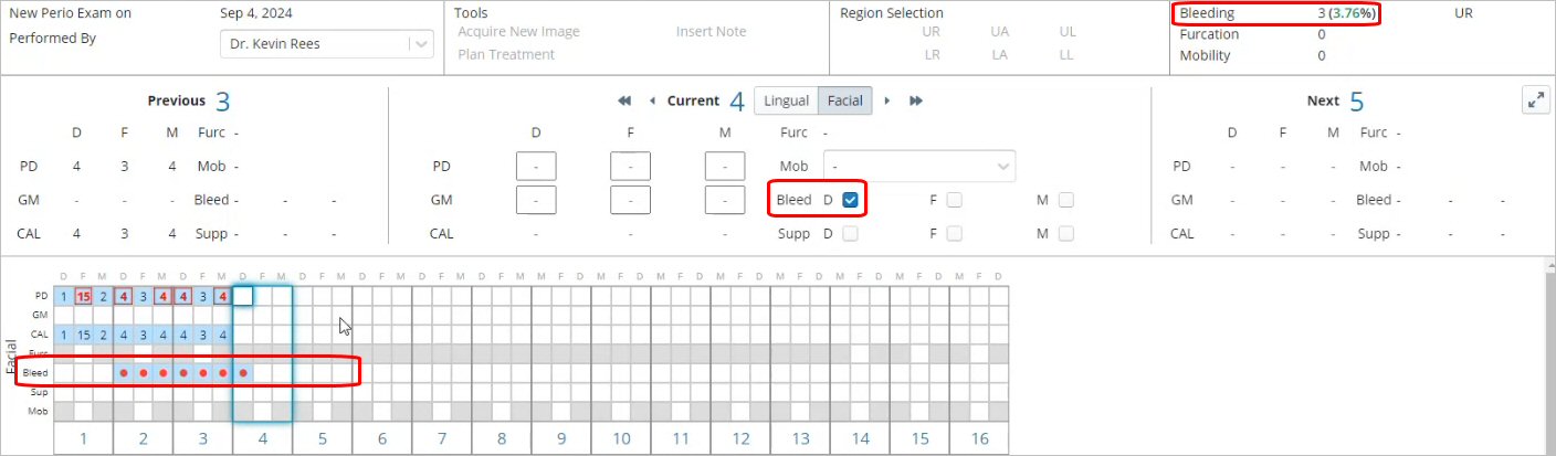 NewPerioBleed.jpg