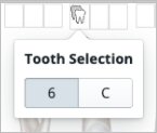 MixedDentPicker.jpg